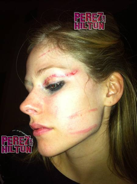 Avril Lavigne picchiata: la foto