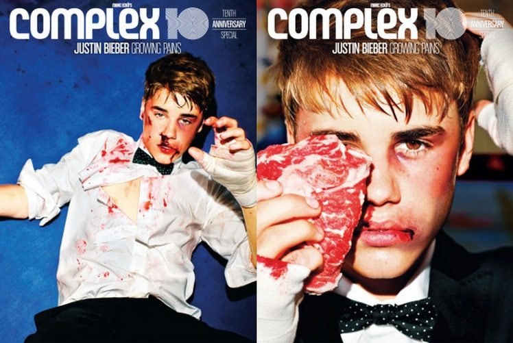 Justin Bieber, lividi e sangue per la copertina di Complex