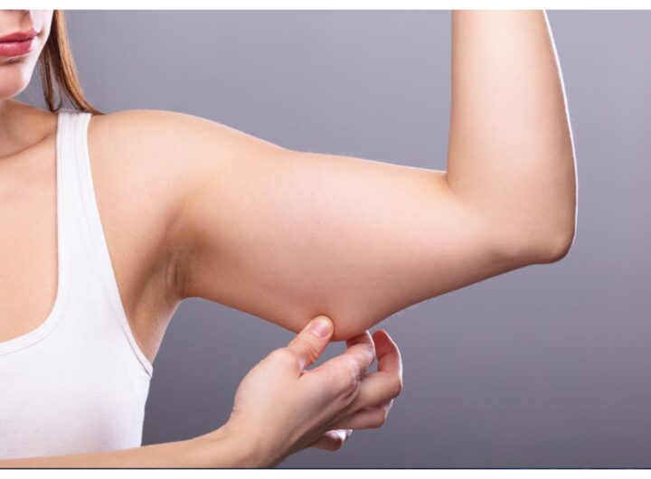 braccia a tendina come prevenirle