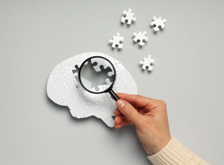 demenza senile precoce