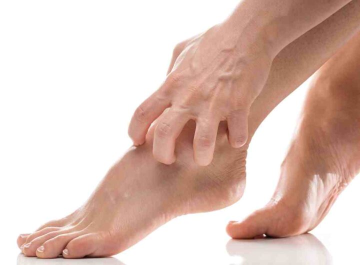 hai spesso prurito alle gambe? potrebbe essere sclerosi multipla